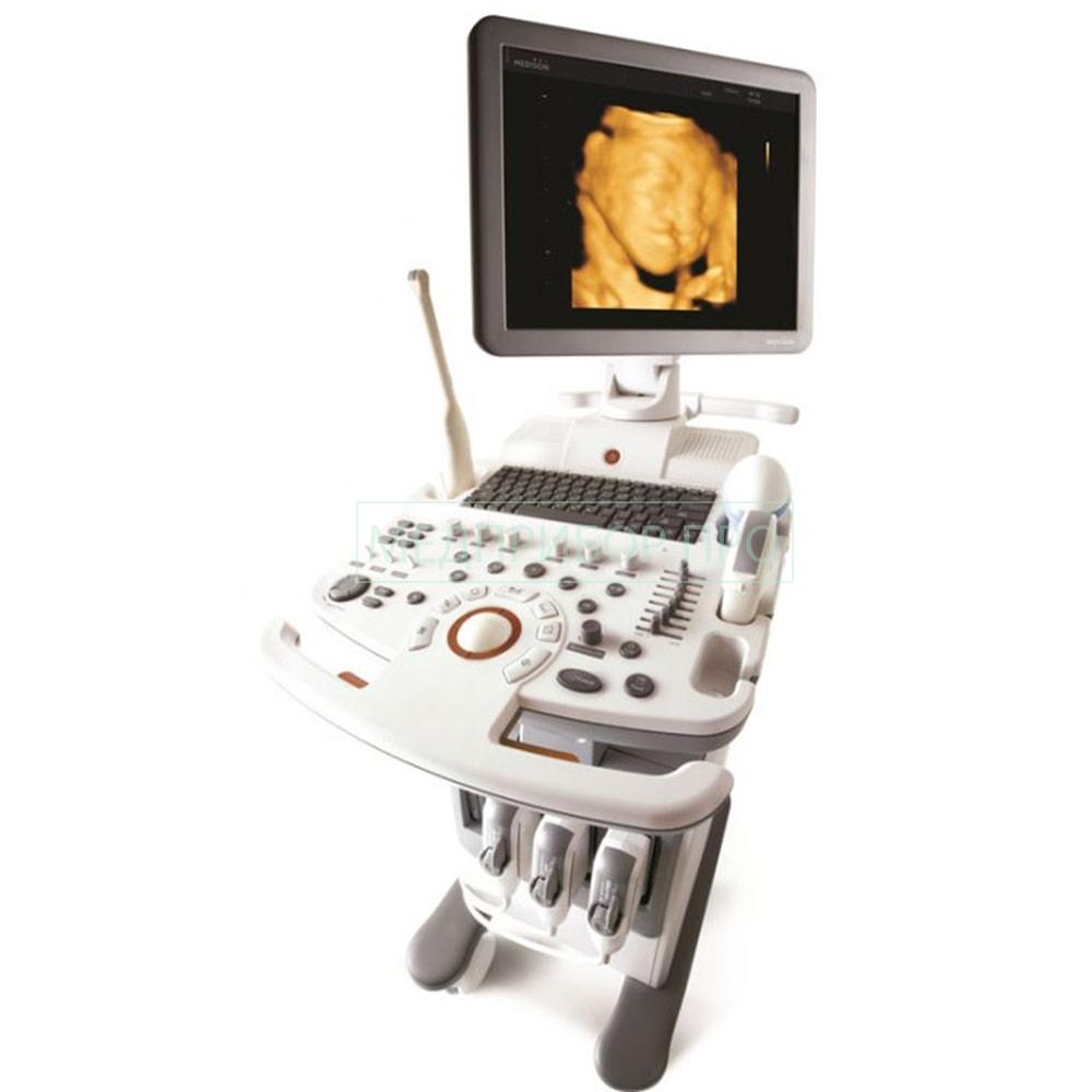 Купить аппарат УЗИ SonoAce R7 от Samsung Medison Купить аппарат УЗИ SonoAce R7 от Samsung Medison