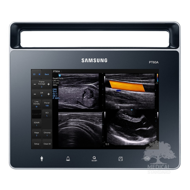 Аппарат УЗИ UGEO PT60A от Samsung Medison