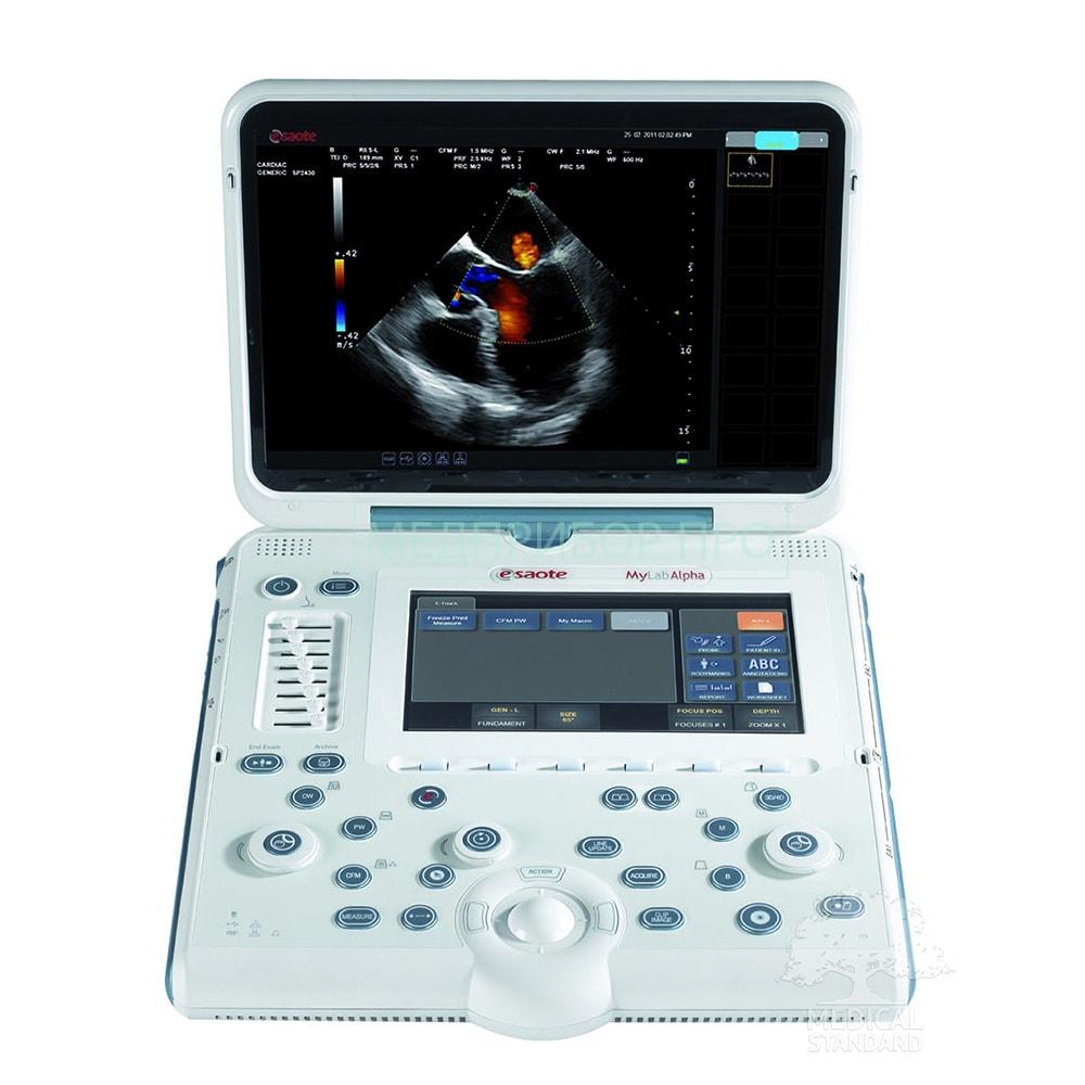 Портативный УЗИ MyLab Alpha от Esaote Портативный УЗИ MyLab Alpha от Esaote