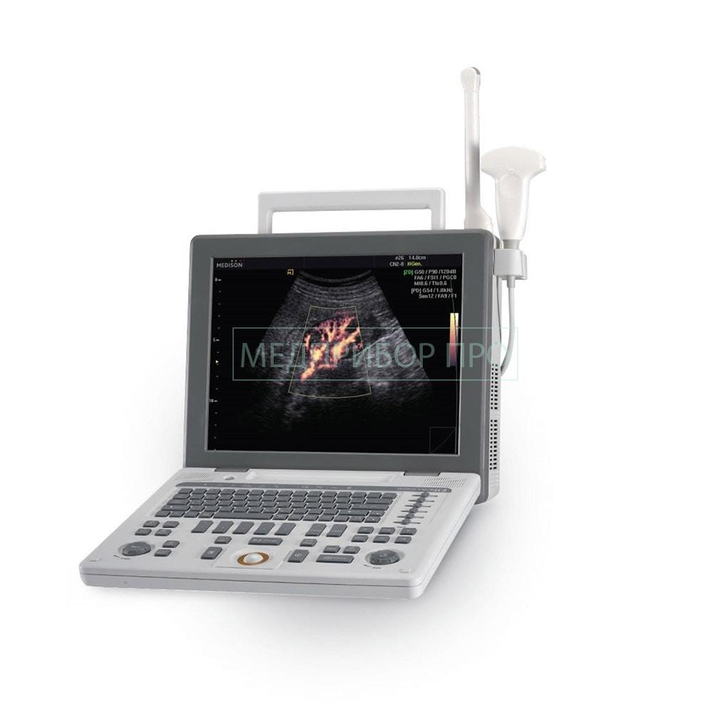 Портативный УЗИ SonoAce R3 от Samsung Medison Портативный УЗИ SonoAce R3 от Samsung Medison