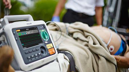 Преимущества дефибриллятора-монитора Efficia DFM100