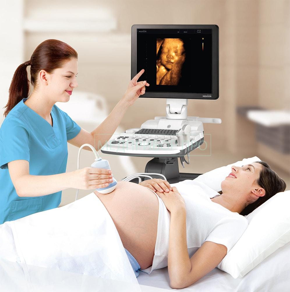 Применение узи самсунг для осмотра плода Применение узи самсунг для осмотра плода