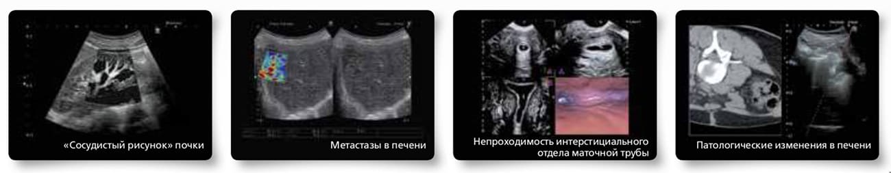 Клинические снимки Клинические снимки