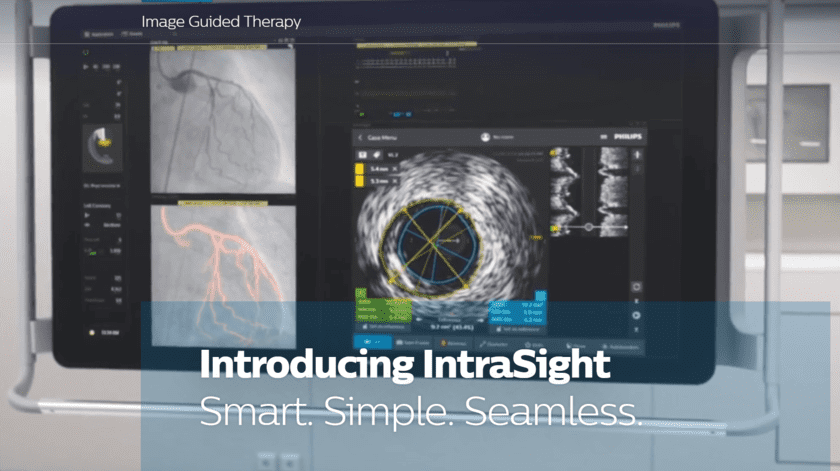 IntraSight-Interventional