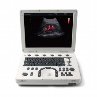 Аппарат УЗИ MySono U5 от Samsung Medison