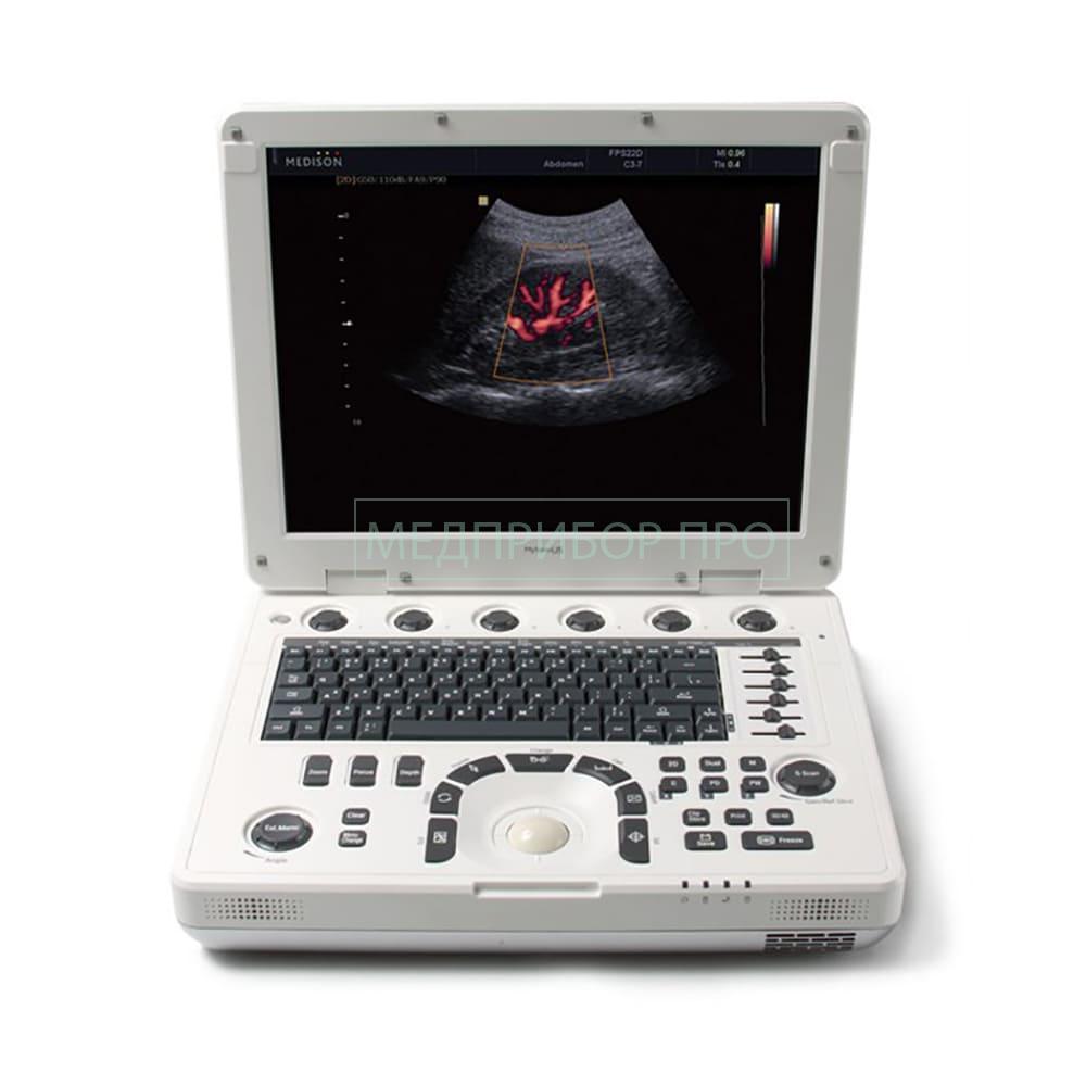 Аппарат УЗИ MySono U5 от Samsung Medison Аппарат УЗИ MySono U5 от Samsung Medison