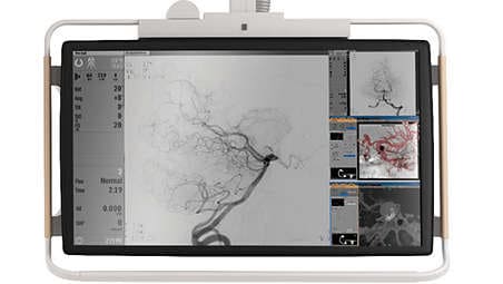 Монитор FlexVision XL display: увеличенные изображения с полным разрешением