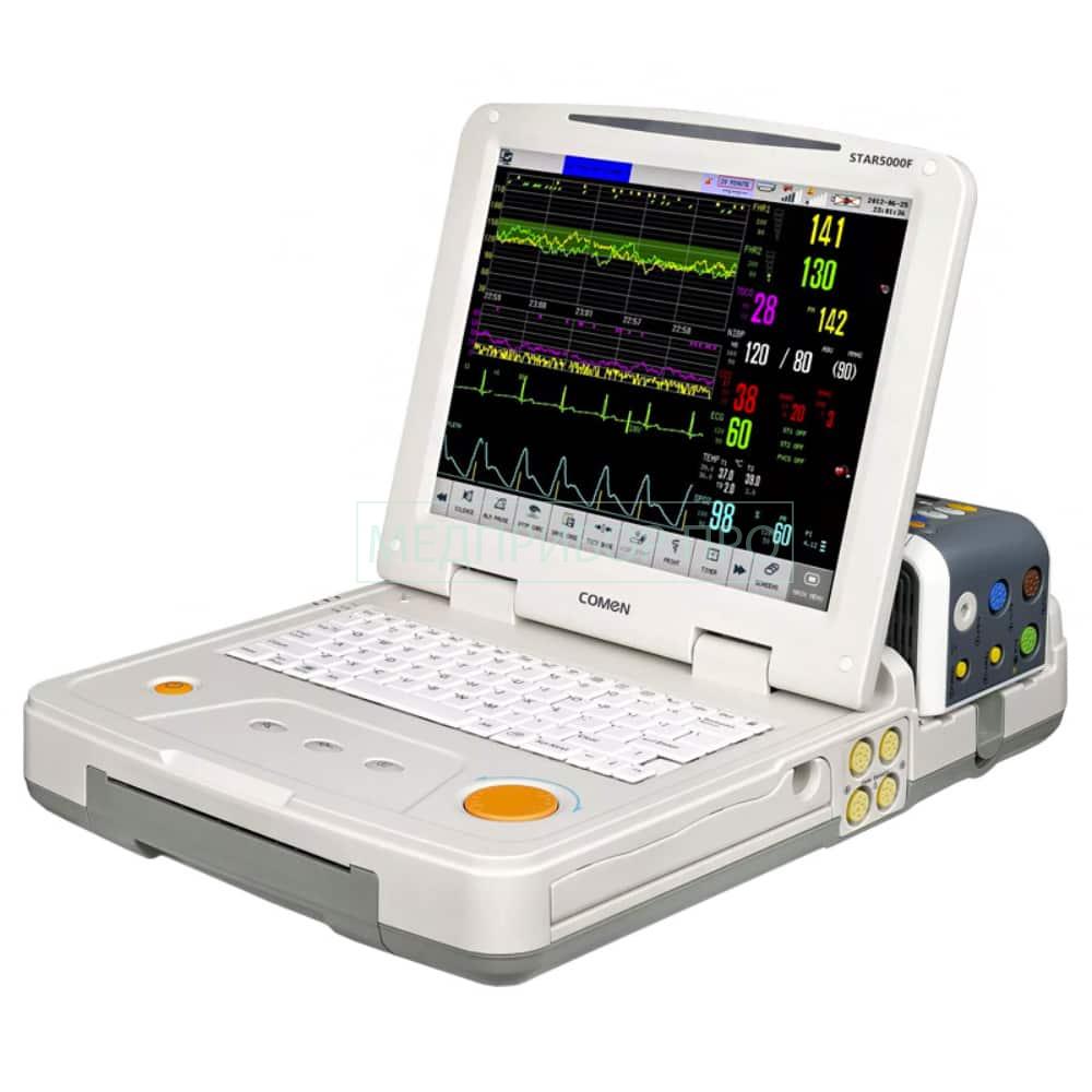 Comen STAR5000F - монитор фетальный Comen STAR5000F - монитор фетальный
