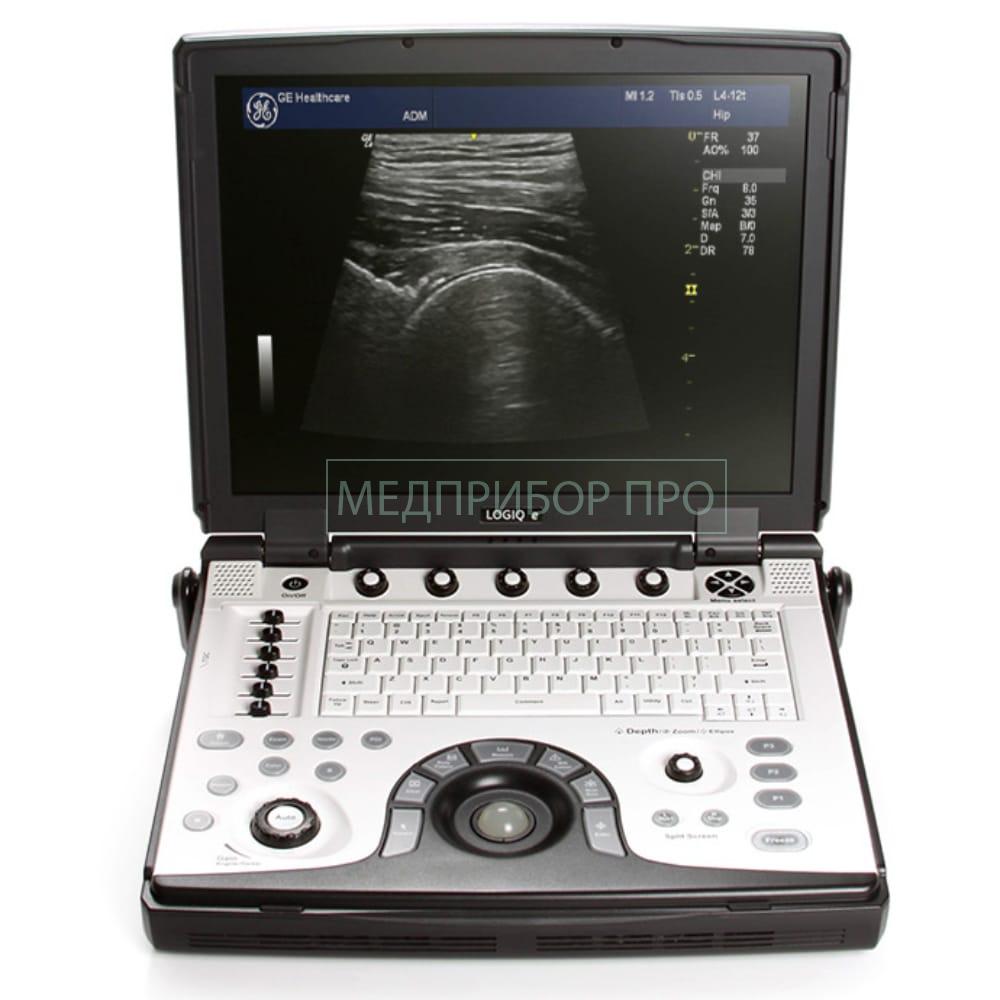 GE Healthcare Logiq E - портативная ультразвуковая система GE Healthcare Logiq E - портативная ультразвуковая система