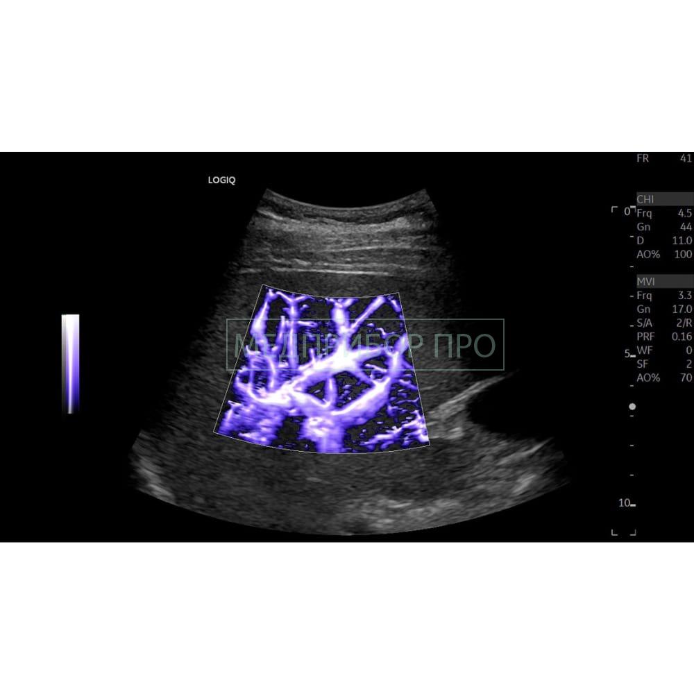 GE Healthcare Logiq E10 - ультразвуковая система1 GE Healthcare Logiq E10 - ультразвуковая система