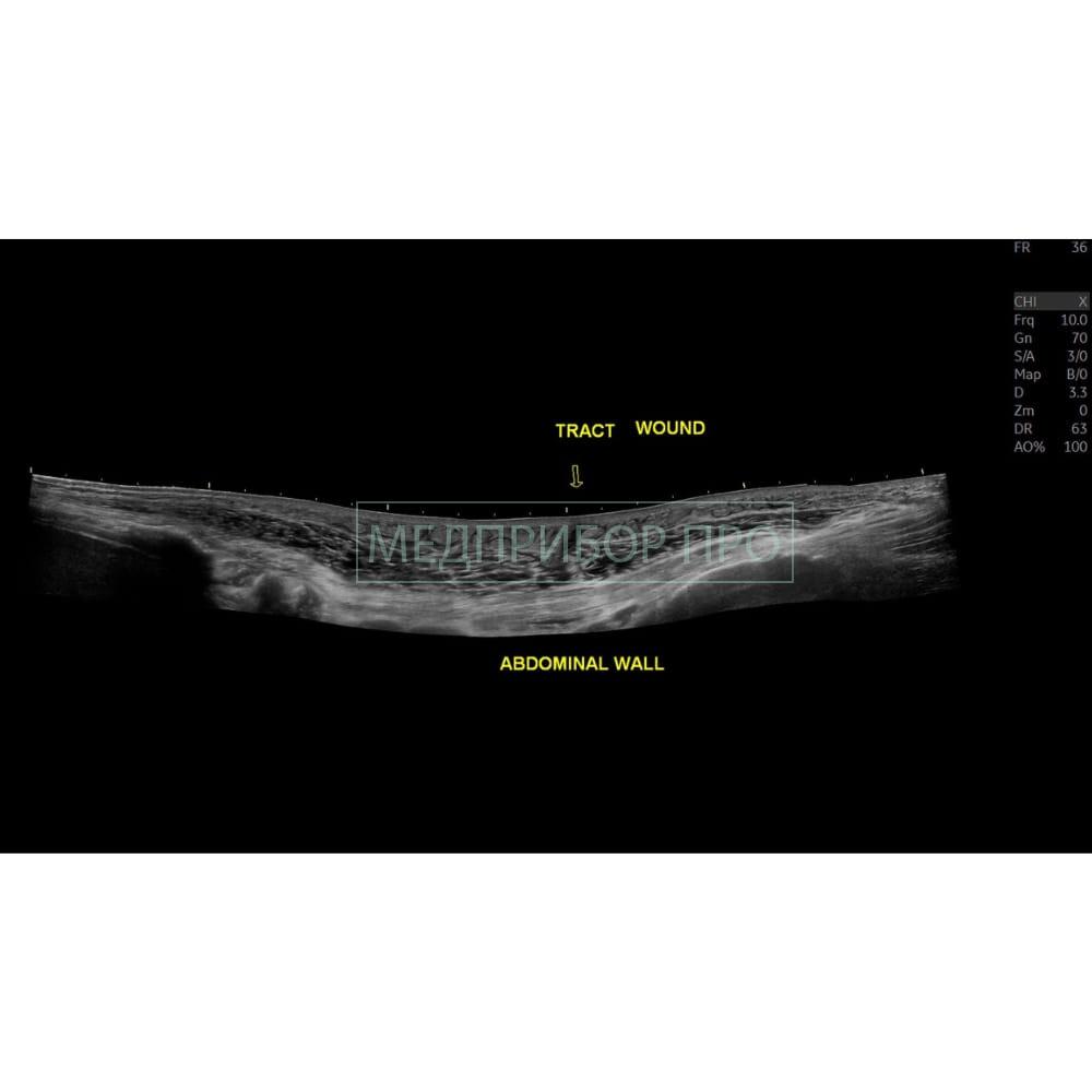 GE Healthcare Logiq E10 - ультразвуковая система2 GE Healthcare Logiq E10 - ультразвуковая система