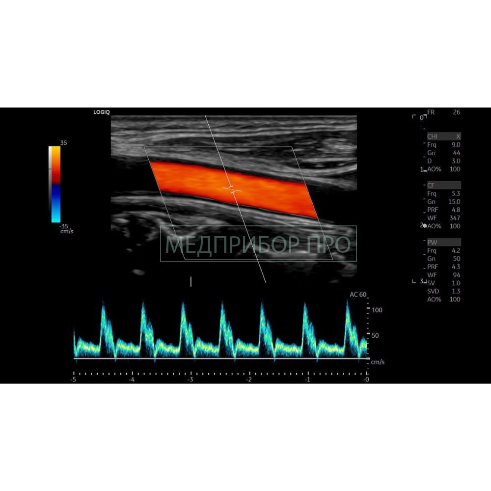 GE Healthcare Logiq E10 - ультразвуковая система GE Healthcare Logiq E10 - ультразвуковая система