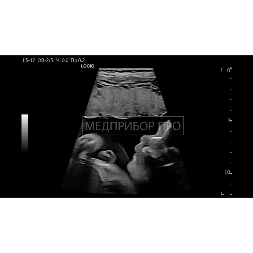 GE Healthcare Logiq E10 - ультразвуковая система4 GE Healthcare Logiq E10 - ультразвуковая система