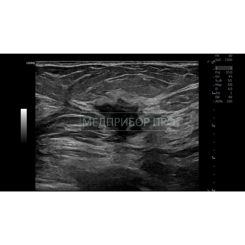 GE Healthcare Logiq E10 - ультразвуковая система GE Healthcare Logiq E10 - ультразвуковая система