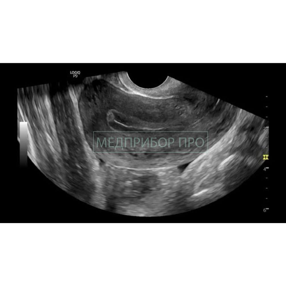 GE Healthcare Logiq P9 - ультразвуковая система. jpg GE Healthcare Logiq P9 - ультразвуковая система