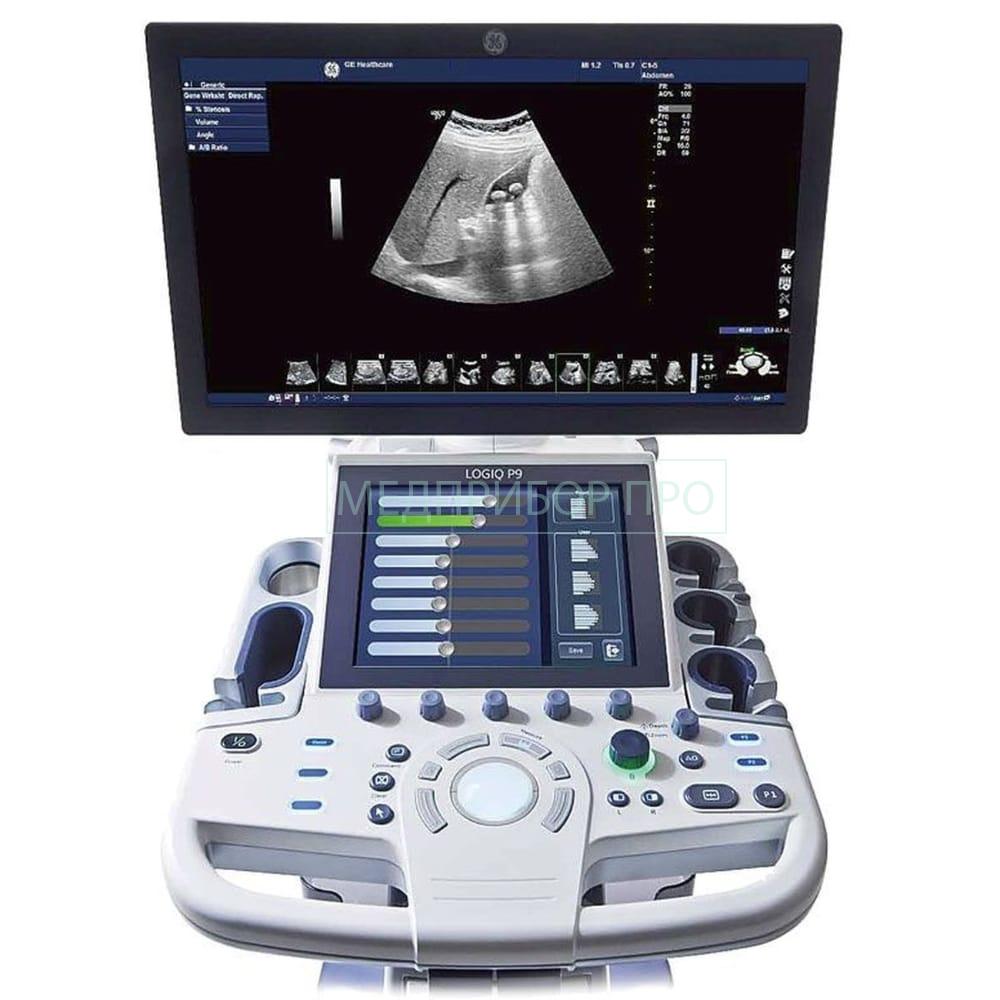 GE Healthcare Logiq P9 - ультразвуковая система GE Healthcare Logiq P9 - ультразвуковая система