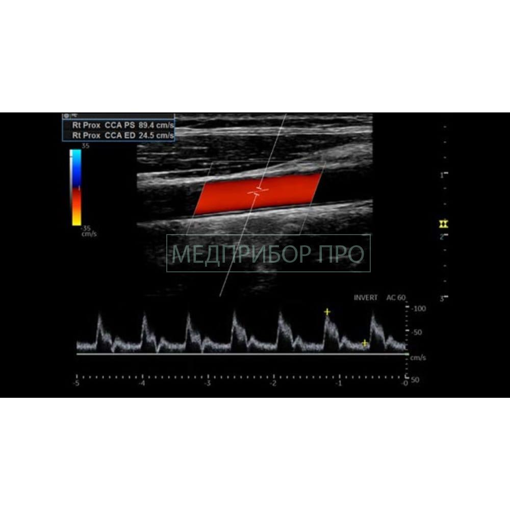 GE Healthcare Logiq P9 - ультразвуковая система1