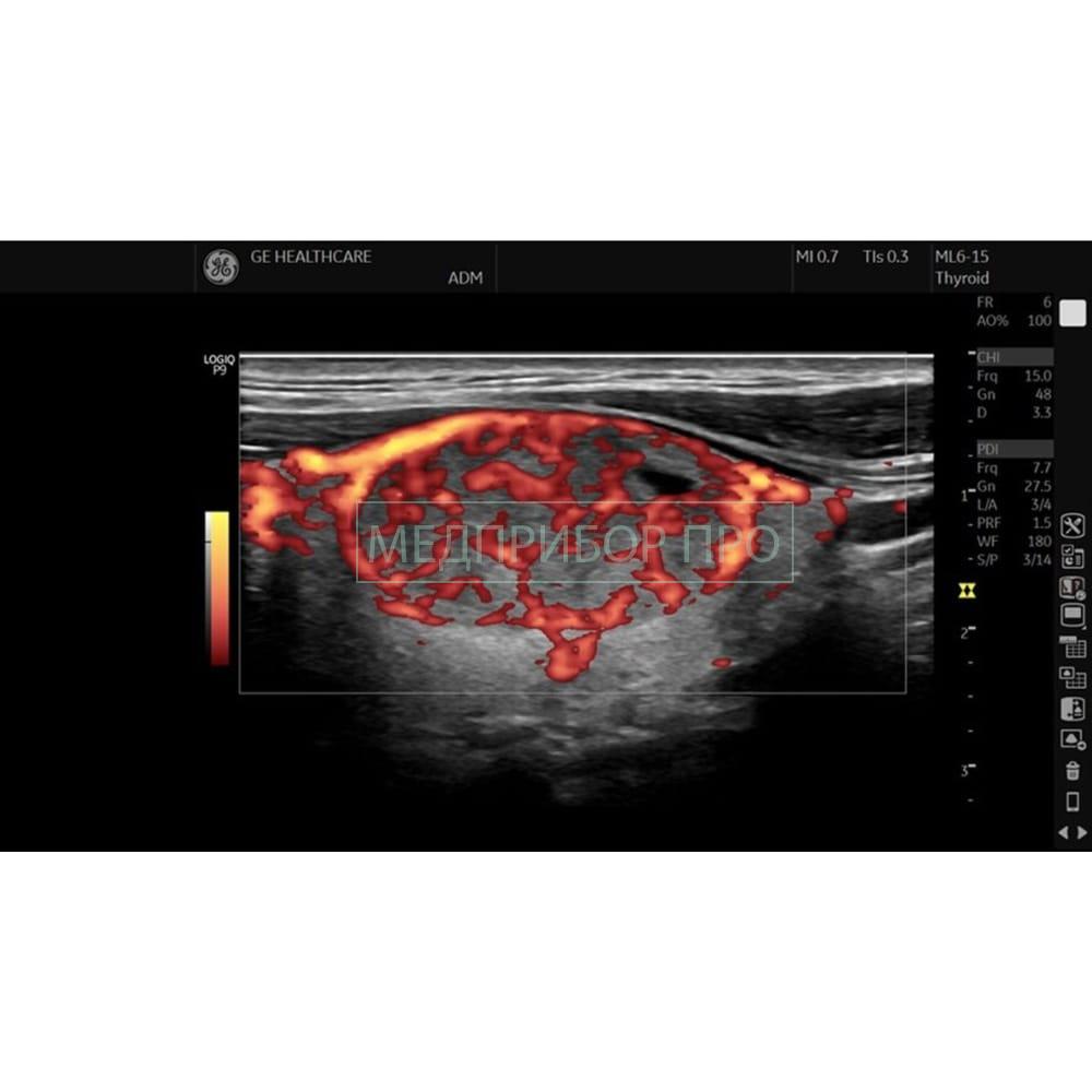GE Healthcare Logiq P9 - ультразвуковая система_ GE Healthcare Logiq P9 - ультразвуковая система