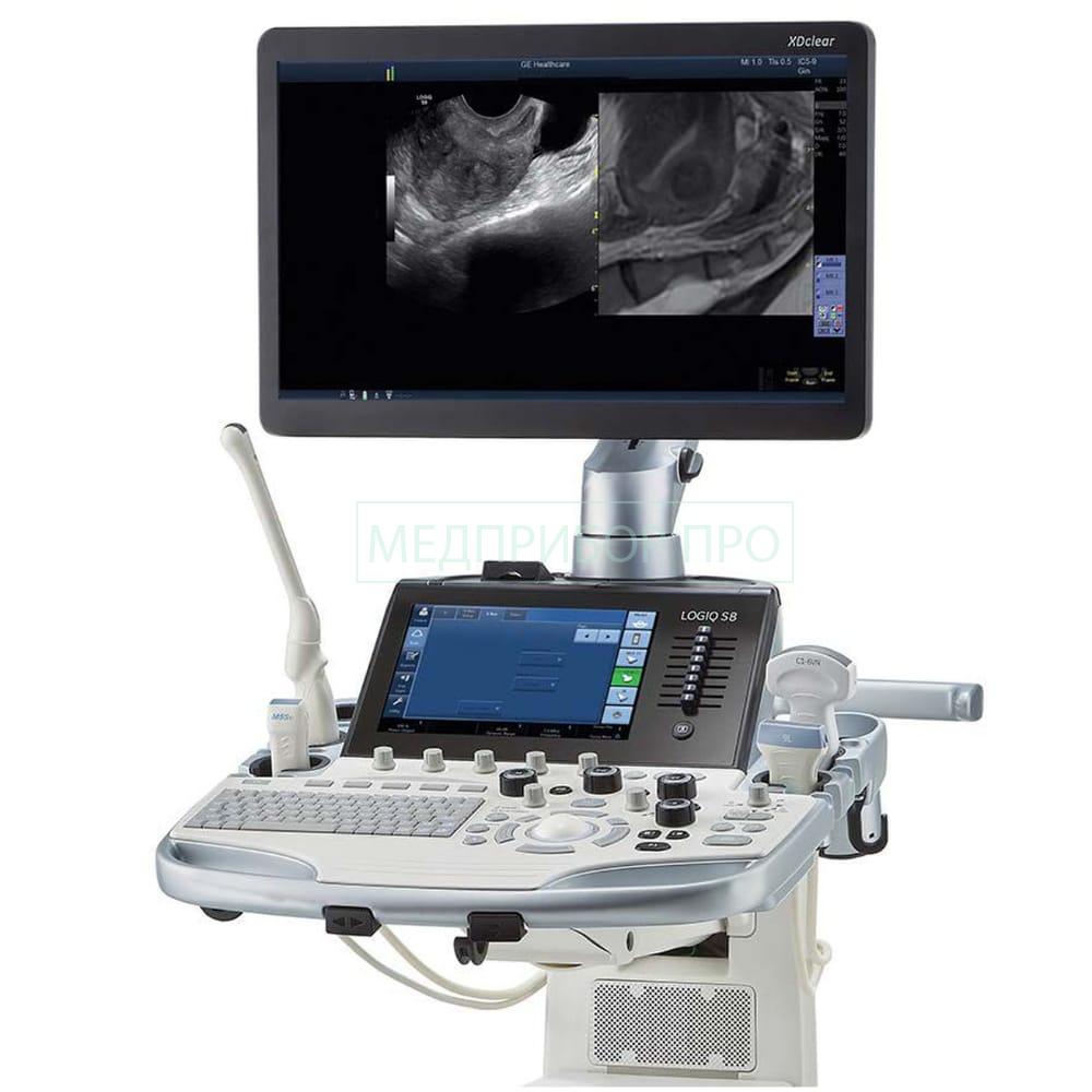 GE Healthcare Logiq S8 XDclear 2.0 - ультразвуковая система GE Healthcare Logiq S8 XDclear 2.0 - ультразвуковая система