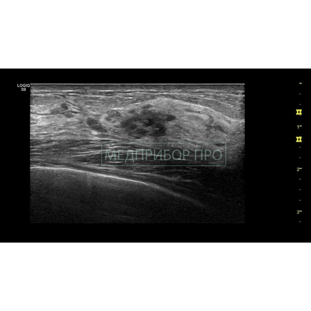 GE Healthcare Logiq S8 XDclear 2.0 - ультразвуковая система. jpg GE Healthcare Logiq S8 XDclear 2.0 - ультразвуковая система