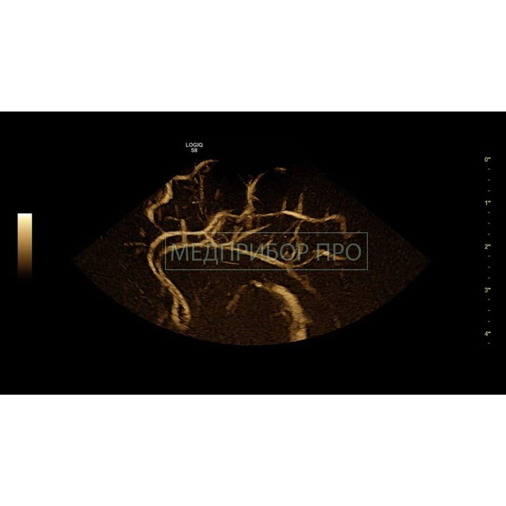 GE Healthcare Logiq S8 XDclear 2.0 - ультразвуковая система1 GE Healthcare Logiq S8 XDclear 2.0 - ультразвуковая система