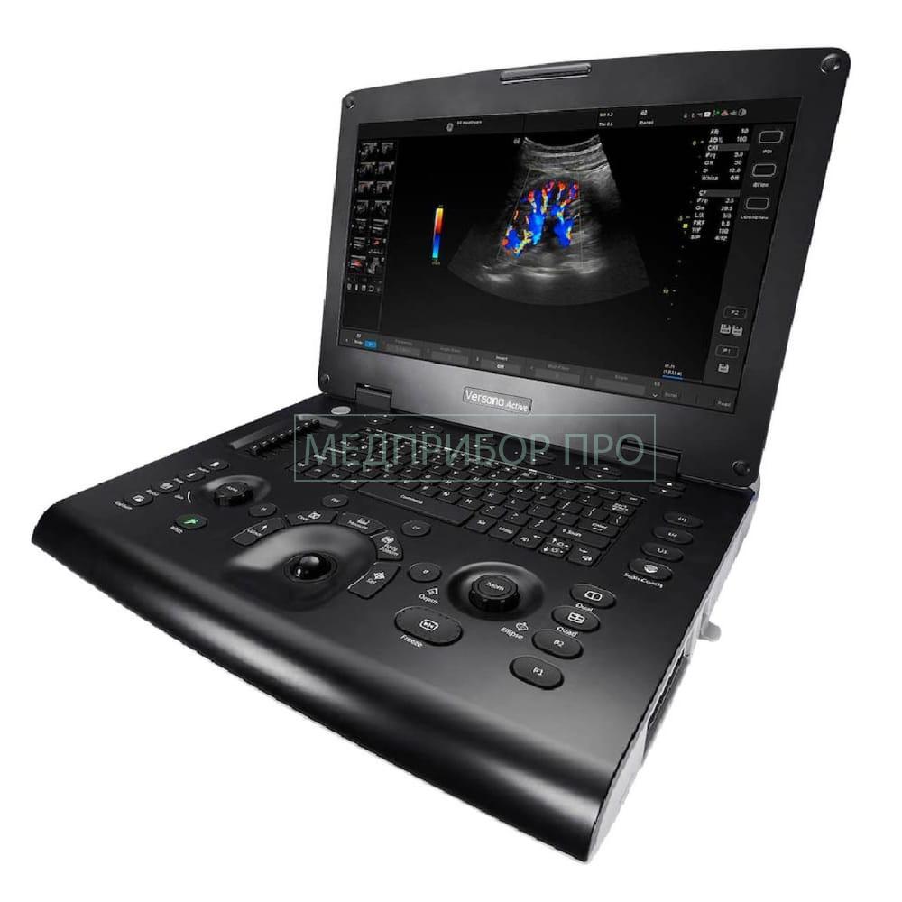 GE Healthcare Versana Active - ультразвуковая система GE Healthcare Versana Active - ультразвуковая система