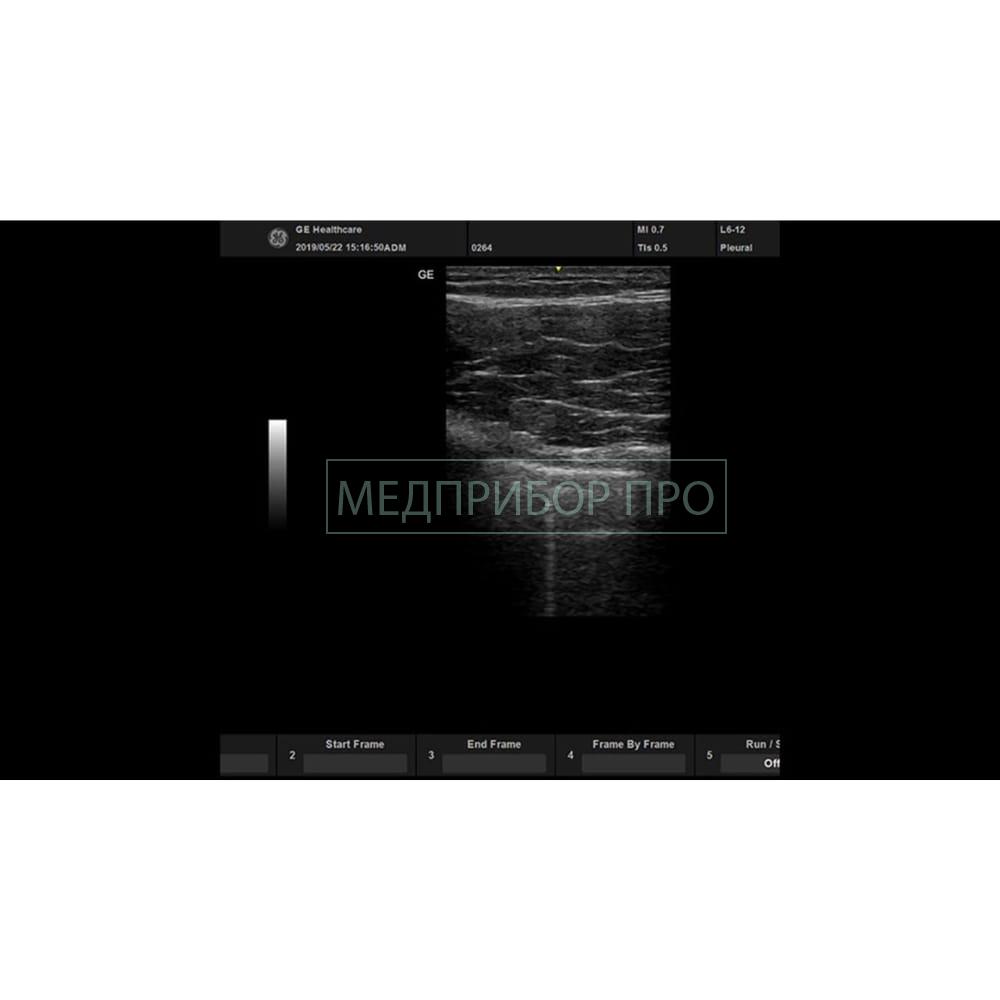 GE Healthcare Versana Active - ультразвуковая система GE Healthcare Versana Active - ультразвуковая система