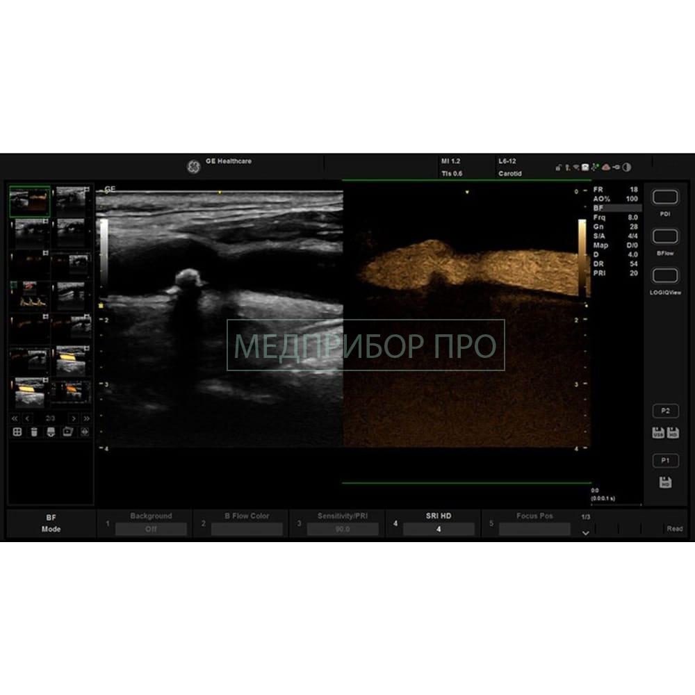 GE Healthcare Versana Active - ультразвуковая система