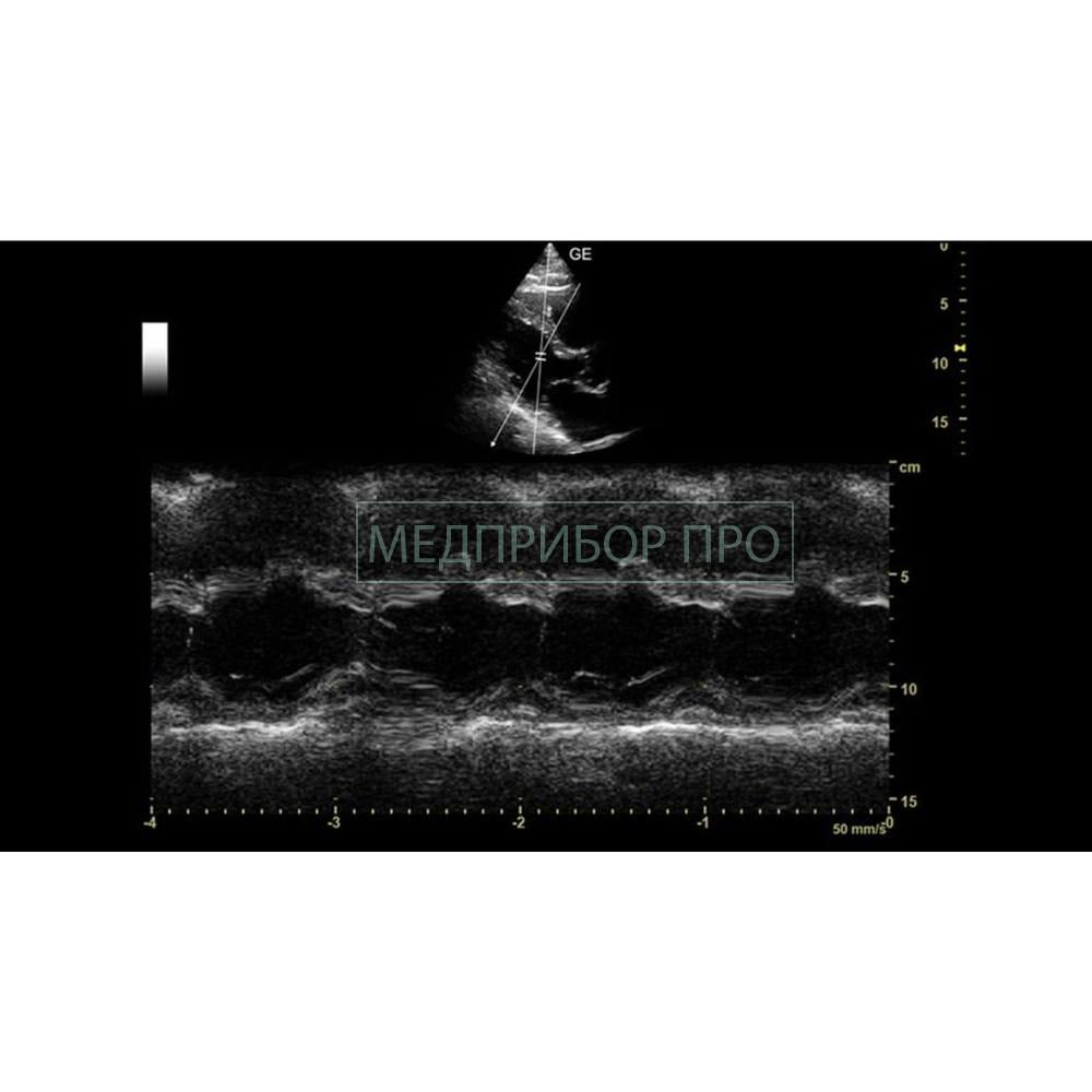 GE Healthcare Versana Balance - ультразвуковая система - GE Healthcare Versana Balance - ультразвуковая система