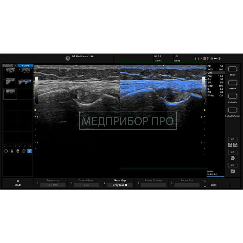 GE Healthcare Versana Balance - ультразвуковая система- GE Healthcare Versana Balance - ультразвуковая система