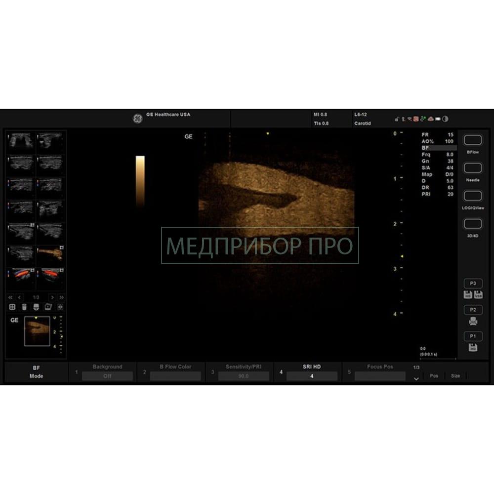 GE Healthcare Versana Balance - ультразвуковая система GE Healthcare Versana Balance - ультразвуковая система