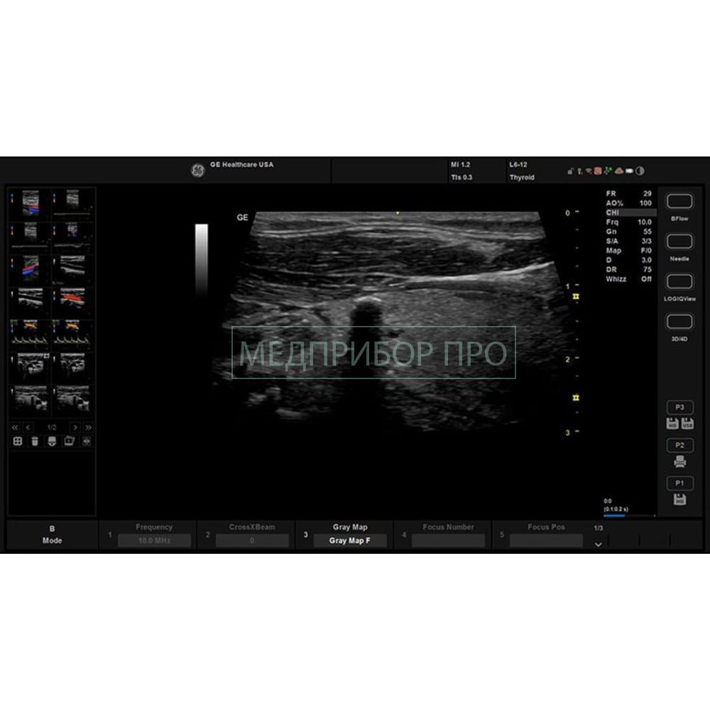 GE Healthcare Versana Balance - ультразвуковая система.jpg GE Healthcare Versana Balance - ультразвуковая система