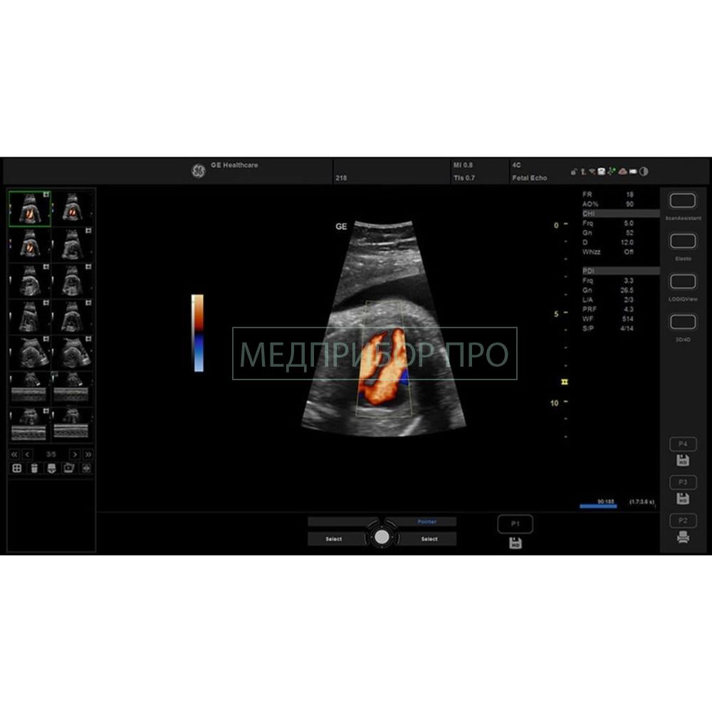 GE Healthcare Versana Premier Black - ультразвуковая система4 GE Healthcare Versana Premier Black - ультразвуковая система