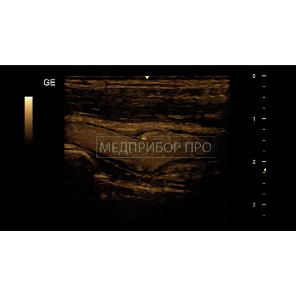 GE Healthcare Versana Premier Black - ультразвуковая система GE Healthcare Versana Premier Black - ультразвуковая система