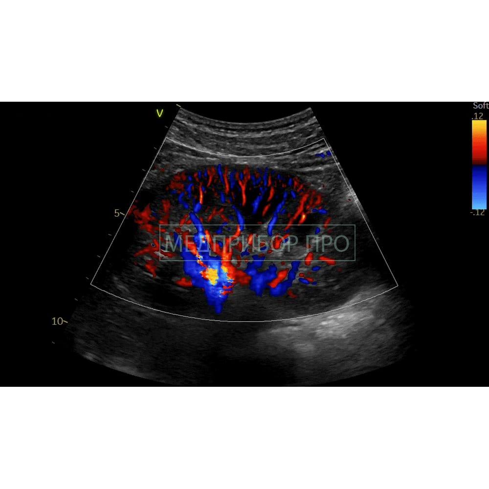 GE Healthcare Vivid E90 - ультразвуковая система.