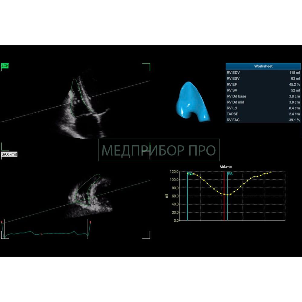 GE Healthcare Vivid E95 - ультразвуковая система. GE Healthcare Vivid E95 - ультразвуковая система