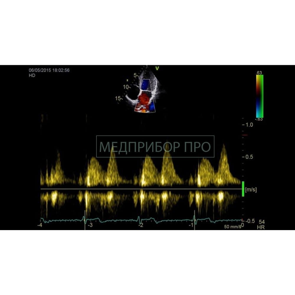 GE Healthcare Vivid IQ - ультразвуковая система-