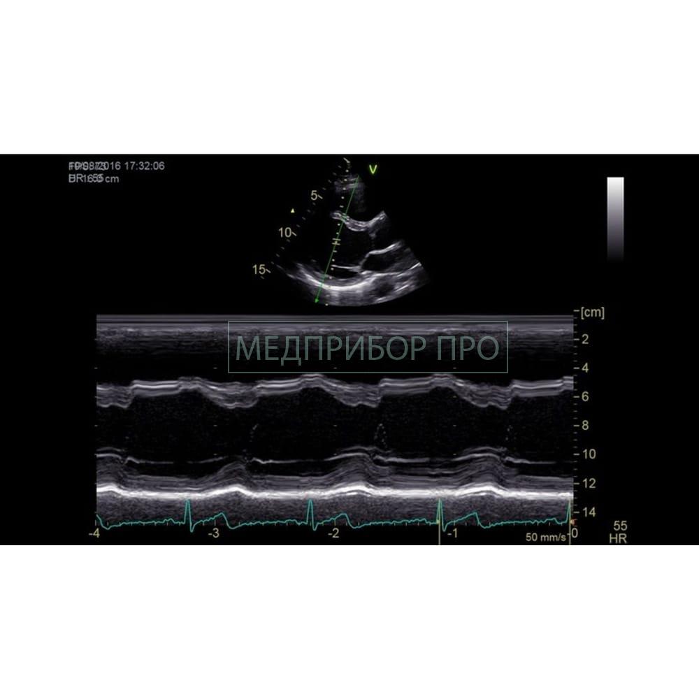 GE Healthcare Vivid IQ - ультразвуковая система GE Healthcare Vivid IQ - ультразвуковая система