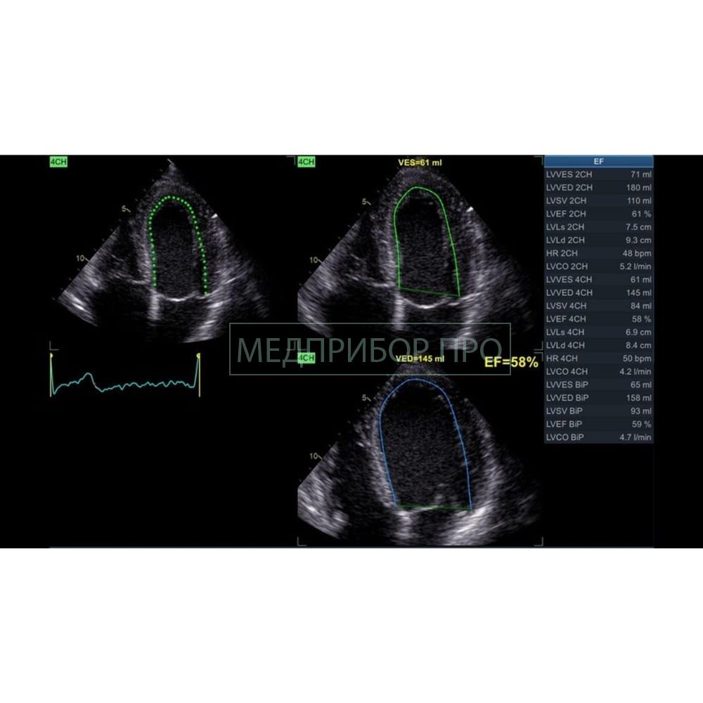 GE Healthcare Vivid IQ - ультразвуковая система GE Healthcare Vivid IQ - ультразвуковая система
