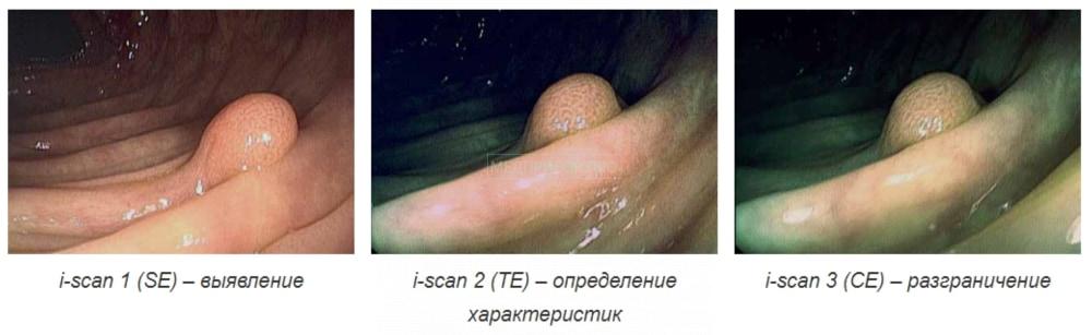 Pentax IMAGINA EPK-i5500c