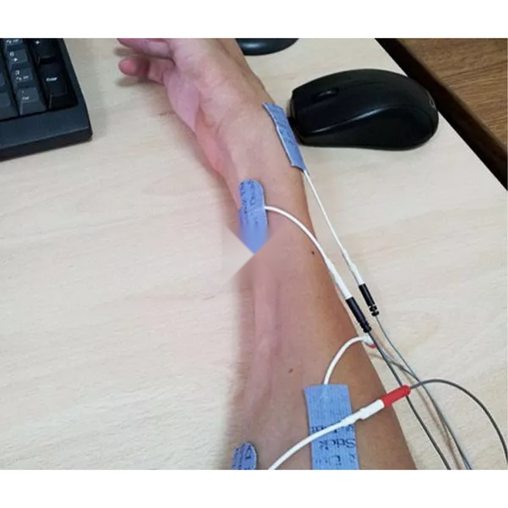 CEFAR REHAB X2 — электромиостимулятор НМЭС/ТЭНС — фото 3
