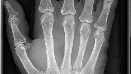 Пример снимков на MobileDiagnost wDR - высокая детализация