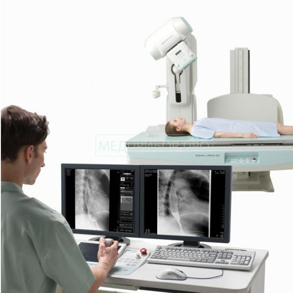 Sonialvision G - телеуправляемый рентгенодиагностический комплекс