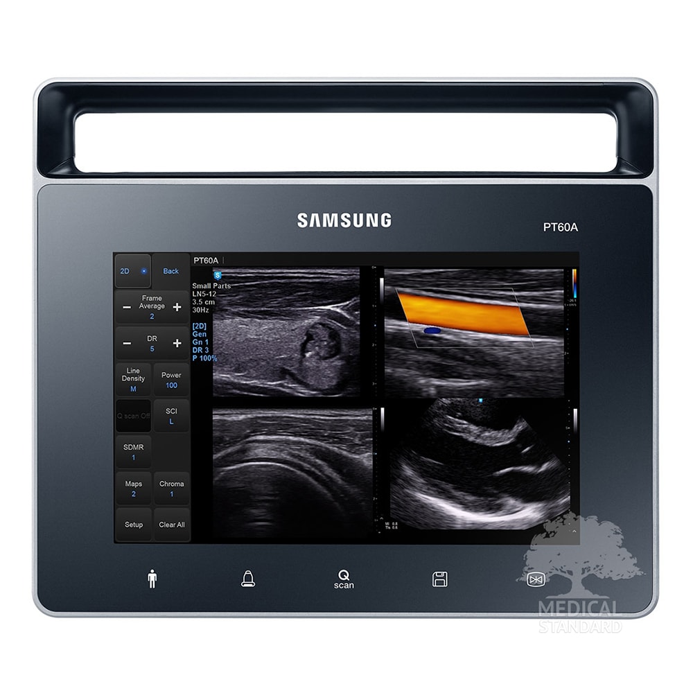 Аппарат УЗИ UGEO PT60A от Samsung Medison