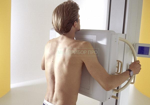 DigitalDiagnost Chest (для исследования грудной клетки)