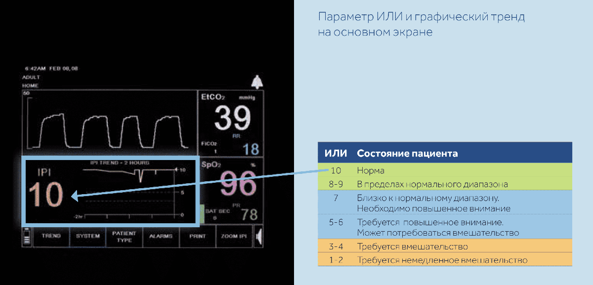 Параметр ИЛИ и графический тренд на основном экране Capnostream 20