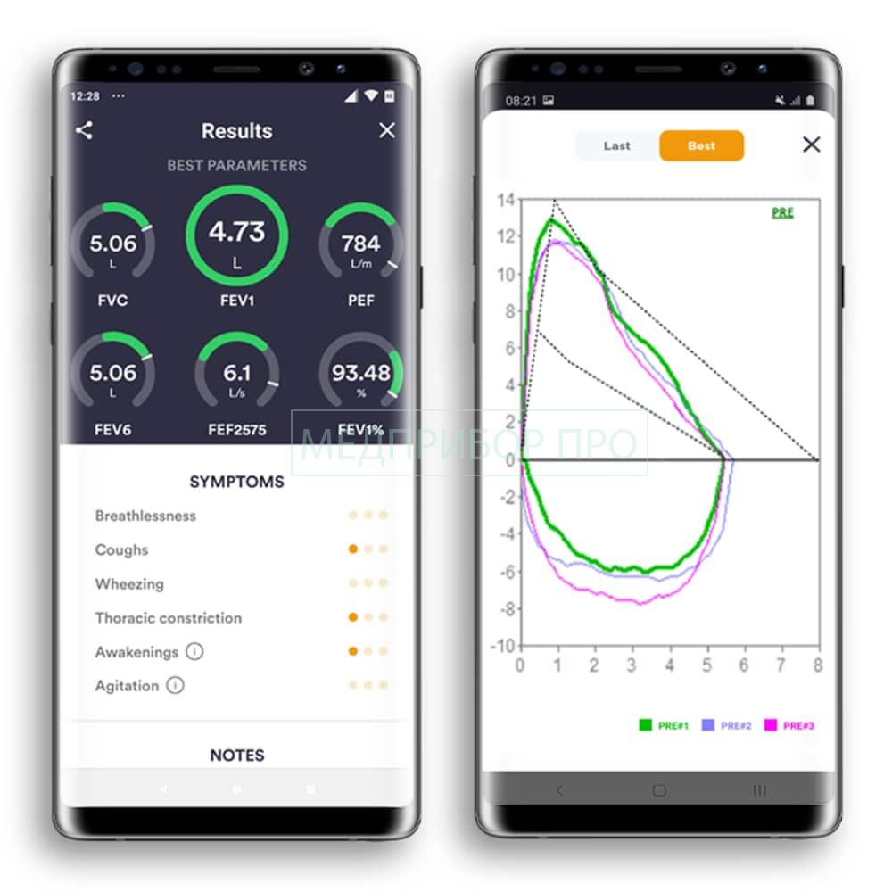 Mir Spirobank Smart - спирометр портативный