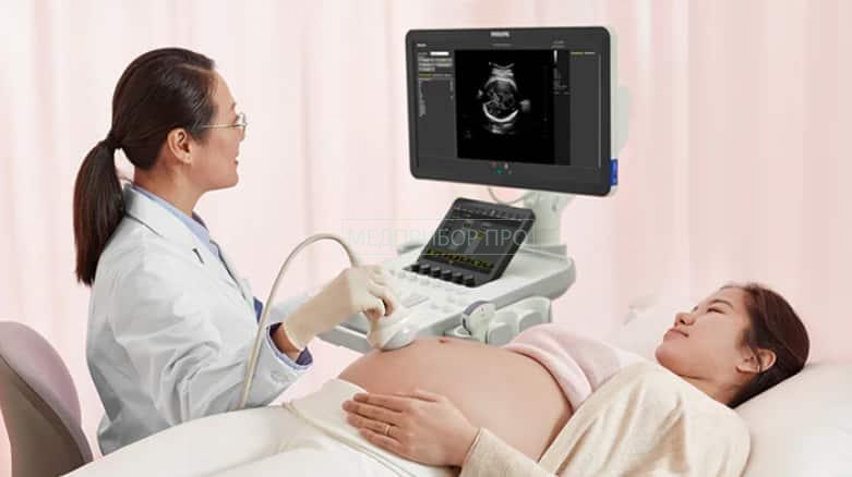 Philips 3300 - УЗИ-аппарат Philips 3300 - УЗИ-аппарат