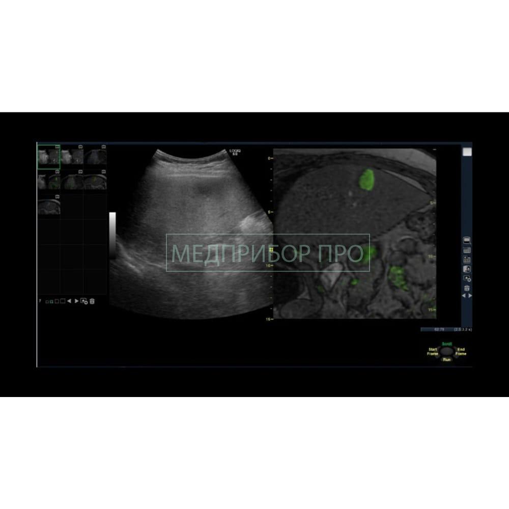 GE Healthcare Logiq S8 XDclear 2.0 - ультразвуковая система