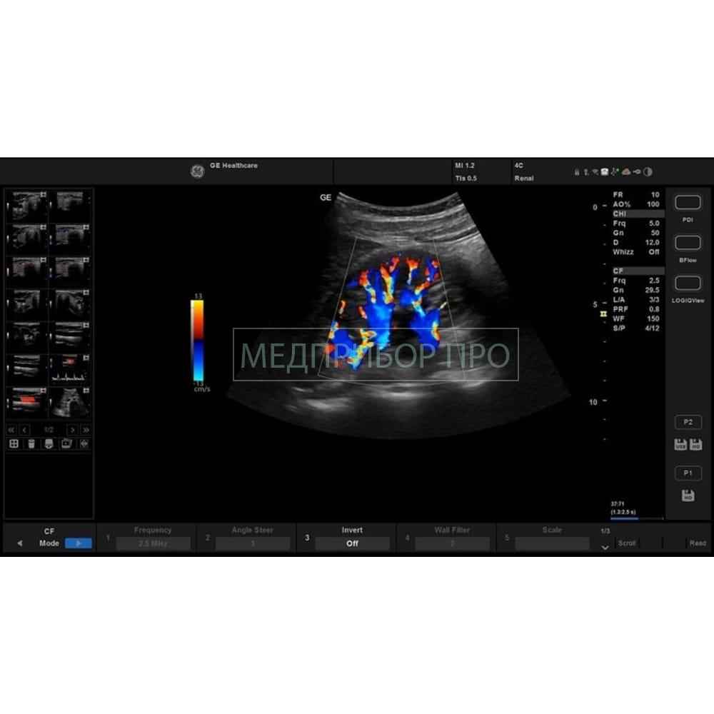 GE Healthcare Versana Active - ультразвуковая система